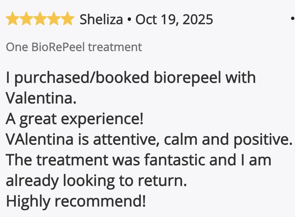 Customer review for BioRePeel treatment, dated October 19, 2025, praising Valentina as attentive, calm, positive, and recommending the treatment.