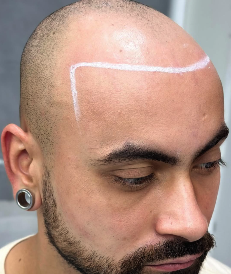 scalp microblading 4.png