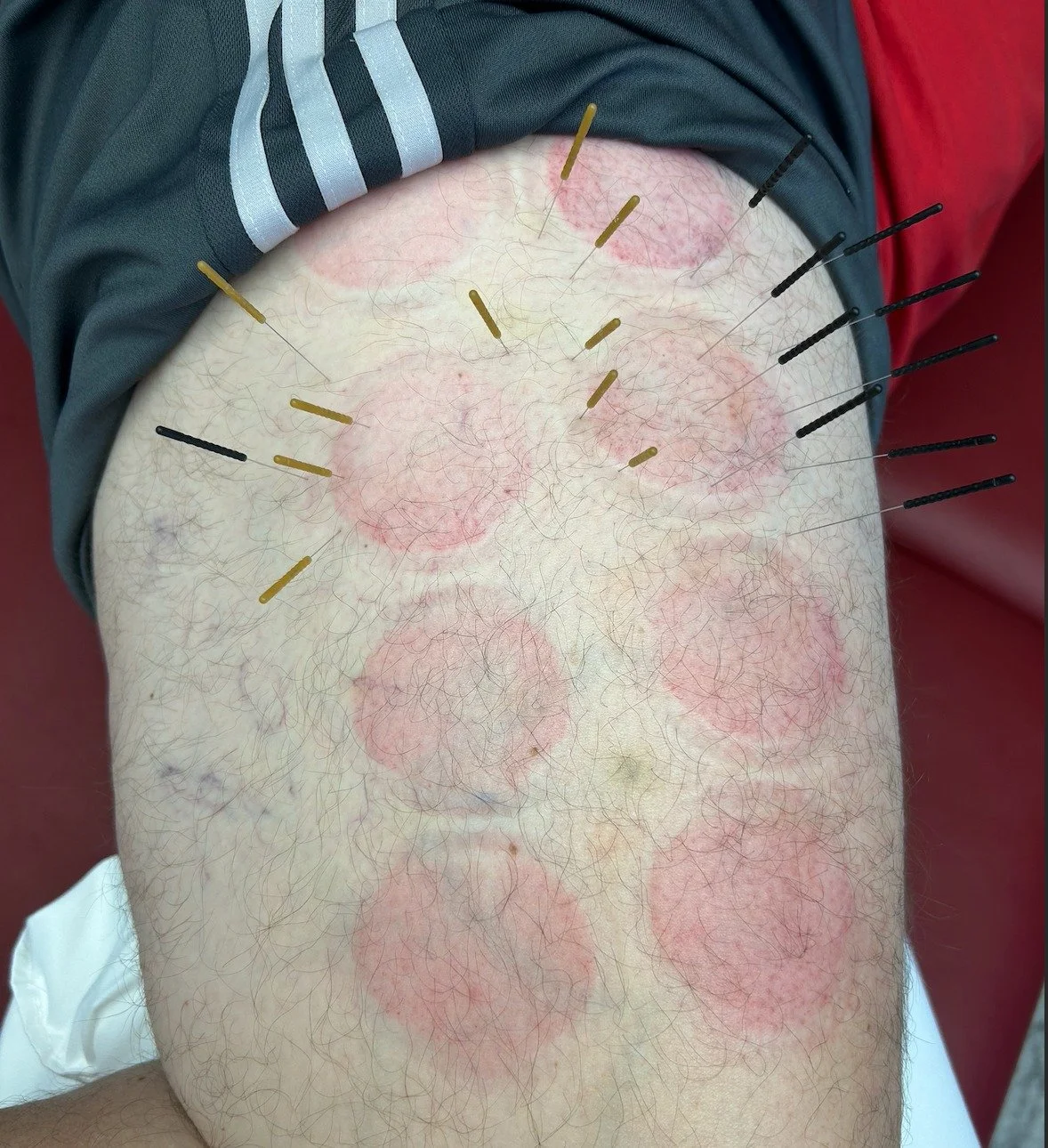 My day was pretty light yesterday with a dry needling session and a pregnancy PT session followed by a graduation from The Rosie Network's Service2Ceo program. It's been a wild 12 weeks working at the clinic, virtually, AND doing a business course pl