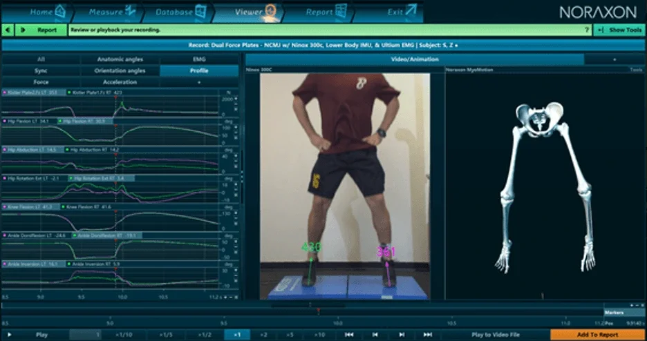 Can Reducing Injuries Really Be THIS Simple?