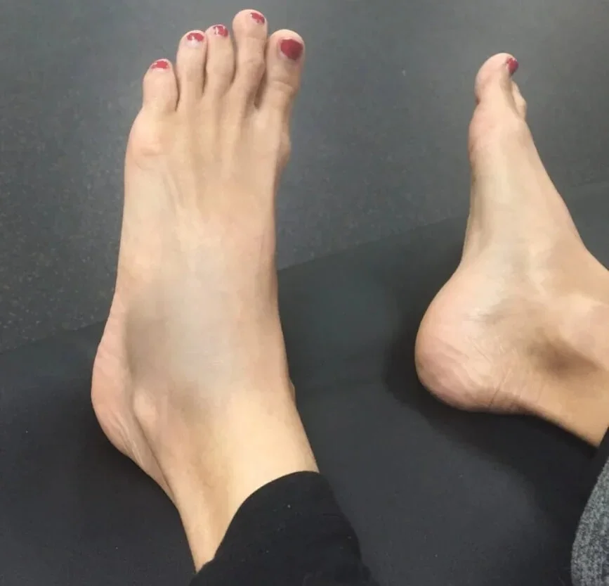 Treating Acute Injuries