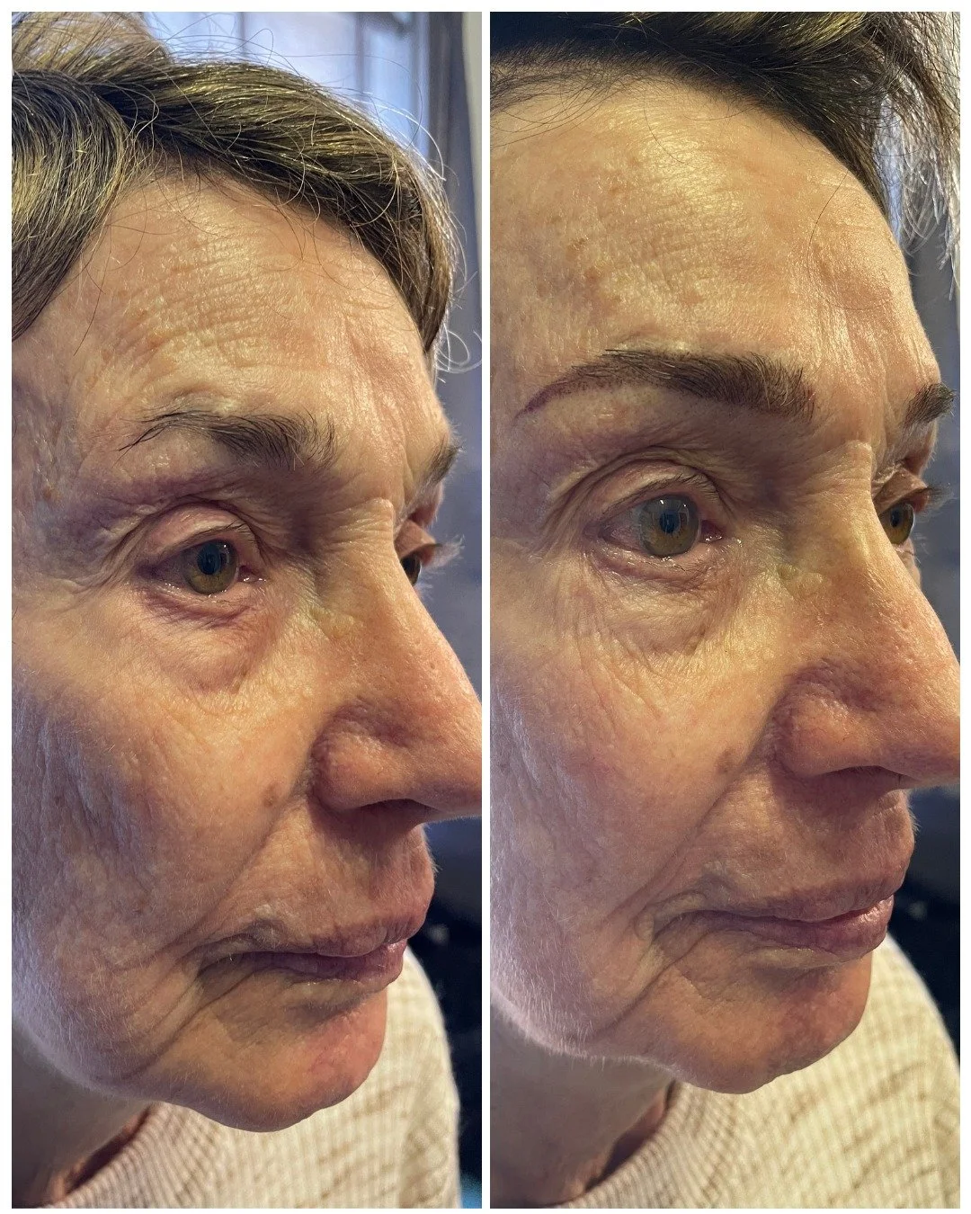 The ends of your brows can completely transform your face! We use precise measurements to find where your brows should start, end, and where the arch should sit. Every detail works together to create a look that can take years off and highlight your 