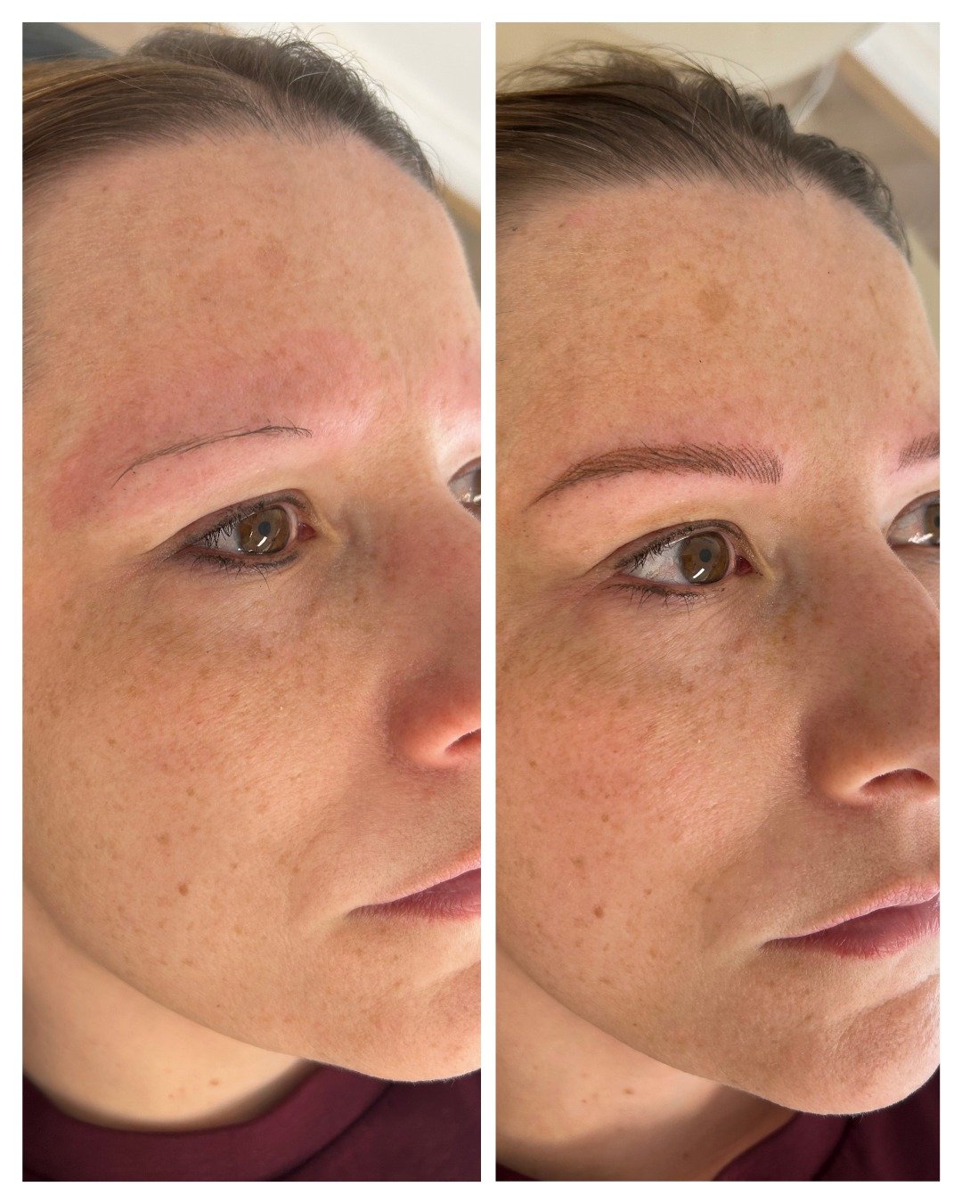 This is a combination of fluffy and natural nano hair strokes with a light dusting of pixelated colour in between the strokes for the most natural results. I love the way these brows turned out.

 #innerwestbrows #browsformatureskin #sydneycosmeticta