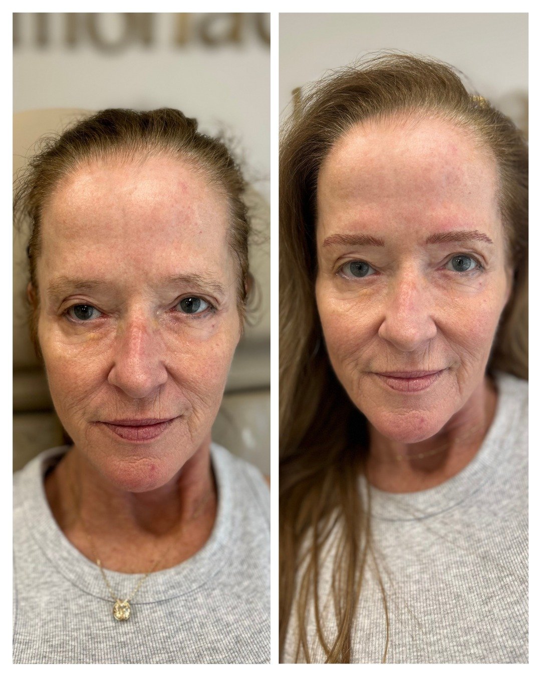 This is what cosmetic brow tattooing looks like when it&rsquo;s tailored, gentle and intentional.
Brows that don&rsquo;t announce themselves &mdash; they simply belong.

#maturebrowtattoo #sydneybrowspecialist #nanohairstrokes #maturebrowsalon