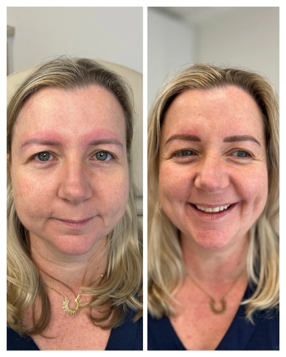 No filters. No trends. Just well-executed cosmetic brow tattooing.

The goal is never to change your face - it&rsquo;s to restore balance, definition and ease to your everyday routine.

#maturebrowtattoo #sydneybrowspecialist #nanohairstrokes #mature