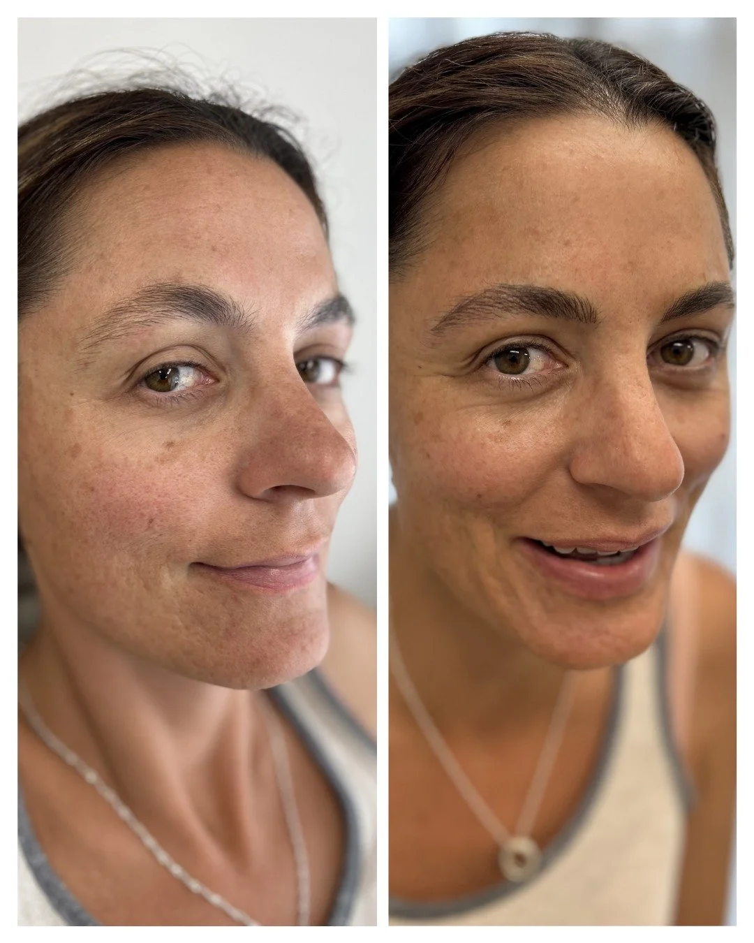 This is how we achieve a natural symmetrical look without needing to pluck, or wax (no hair was removed).

 #nanohairstrokes #maturebrowsalon #maturebrowtattoo #naturalbrowtattoo