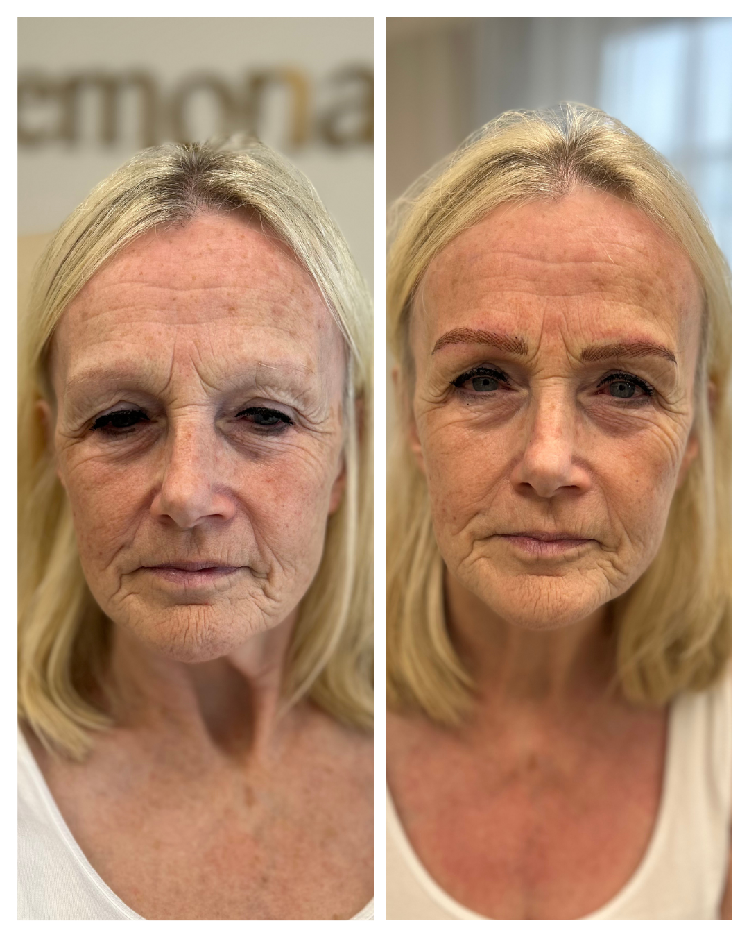 Before After (1).png