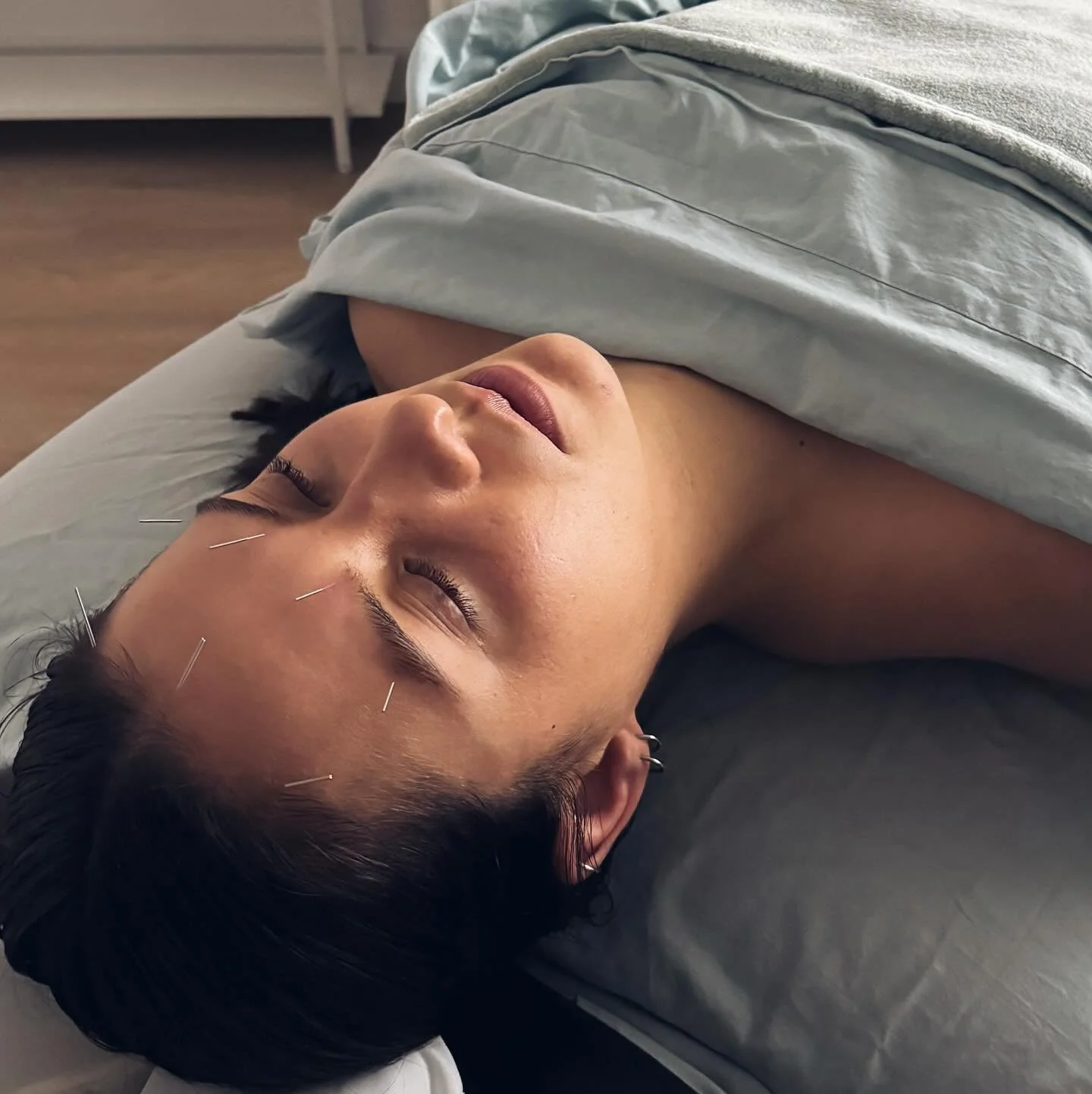 What does acupuncture feel like? Any discomfort is usually brief, passing within an instant. More often than discomfort, you&rsquo;ll experience the feeling of &ldquo;deqi&rdquo; - a unique sensation of heaviness or radiating warmth ✨

A patient of m