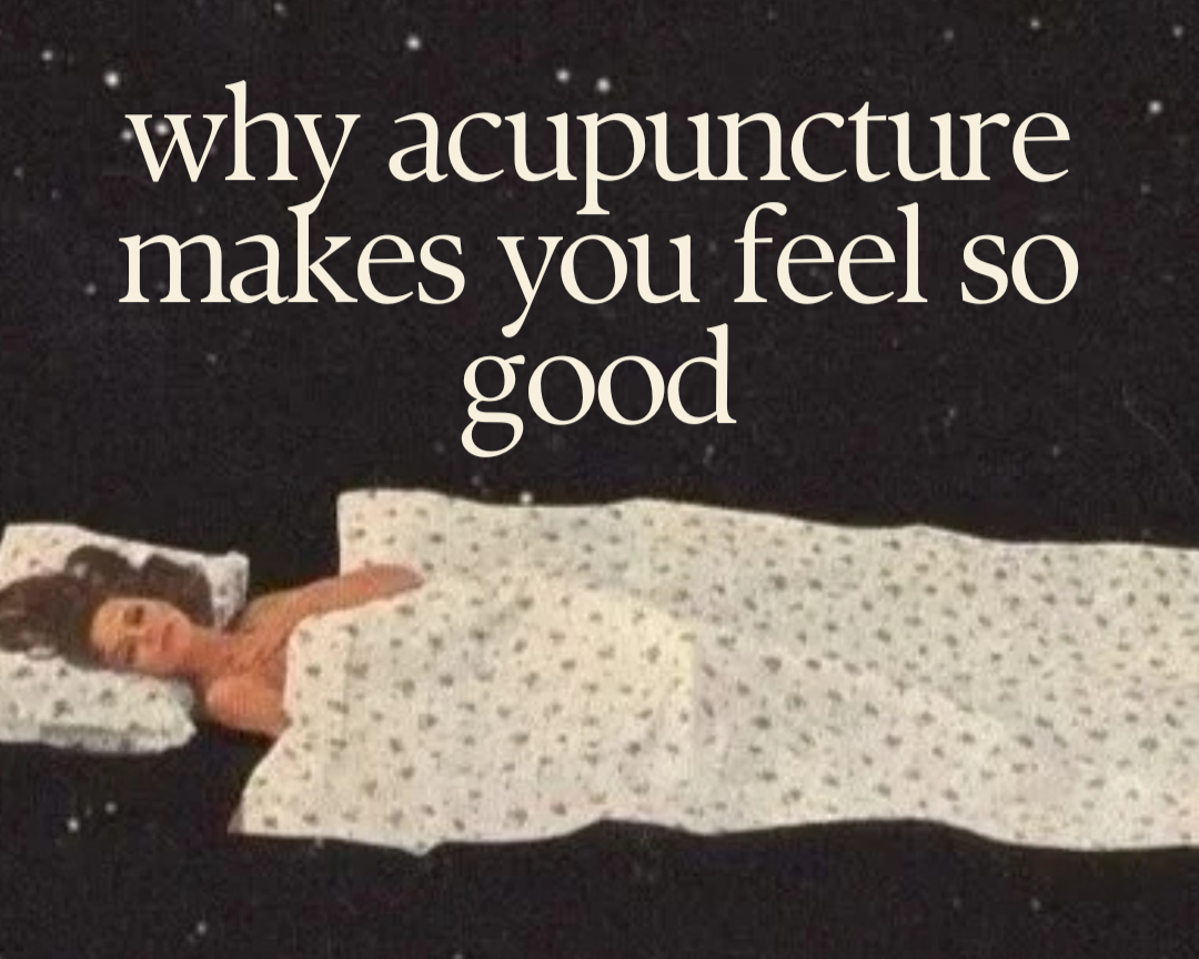 why acupuncture makes you feel so good
