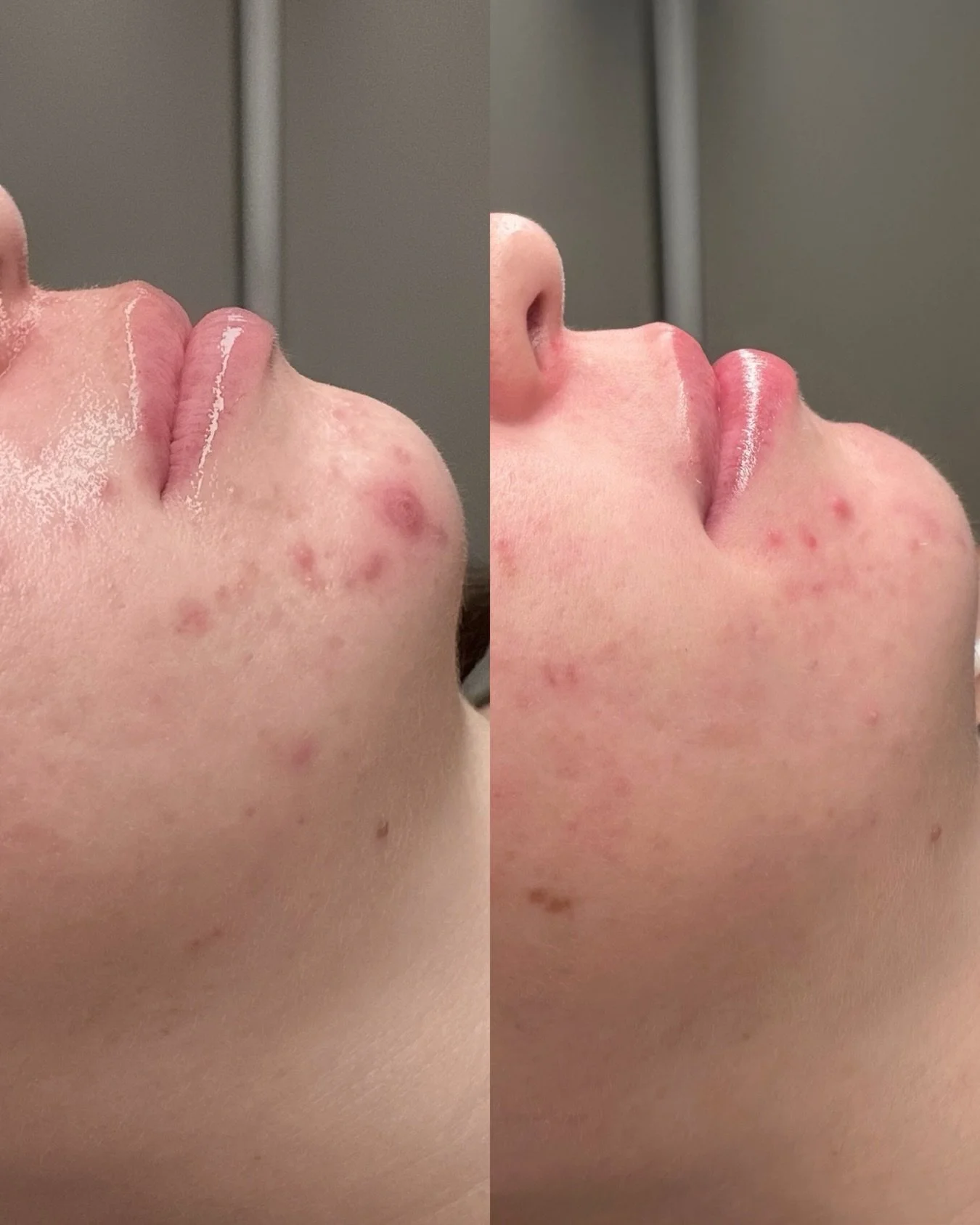 One quality treatment + the right homecare can completely transform your skin after your very first visit ✨

Healthy, glowing skin isn&rsquo;t about doing everything it&rsquo;s about doing the right things consistently.

If you&rsquo;ve been feeling 