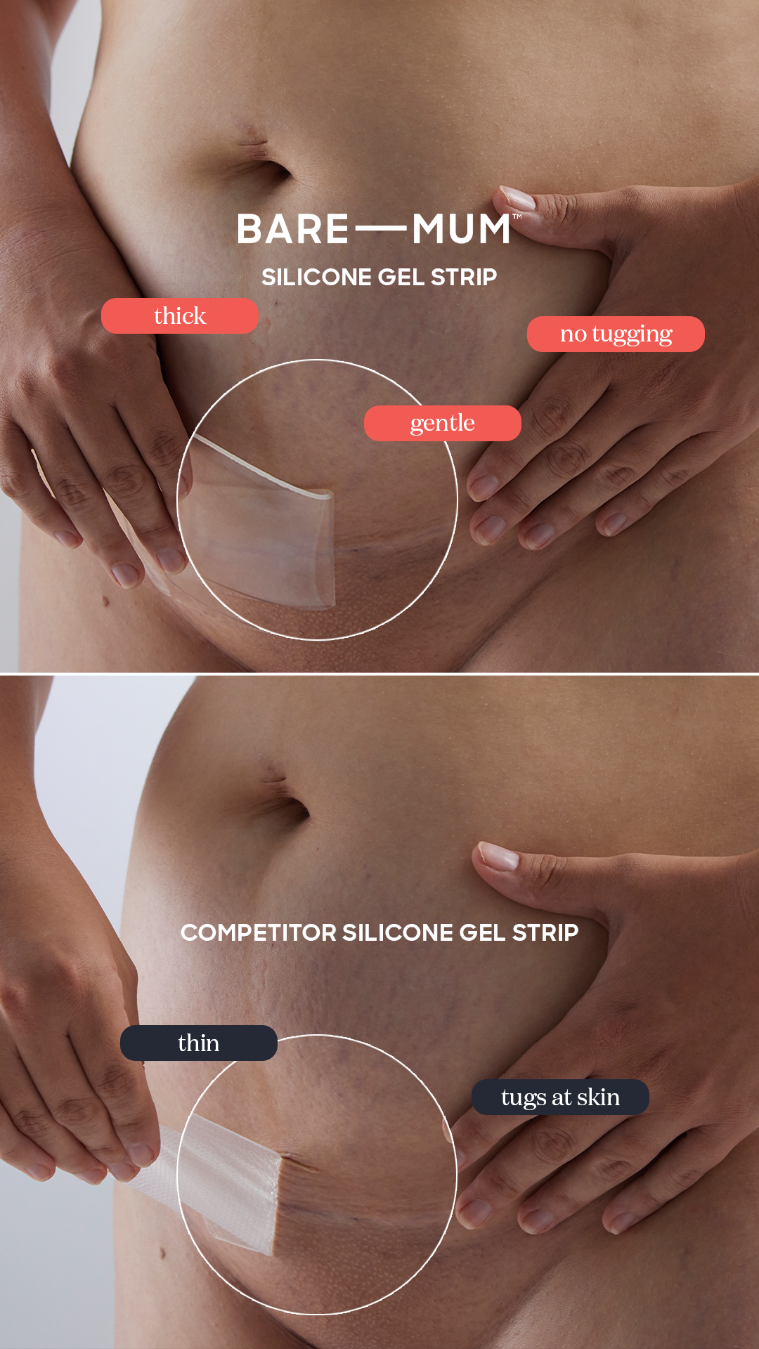 Bare Mum_June BAU Paid Ads_Scar Strips (Ours Vs Competitor)_9_16 V2.png