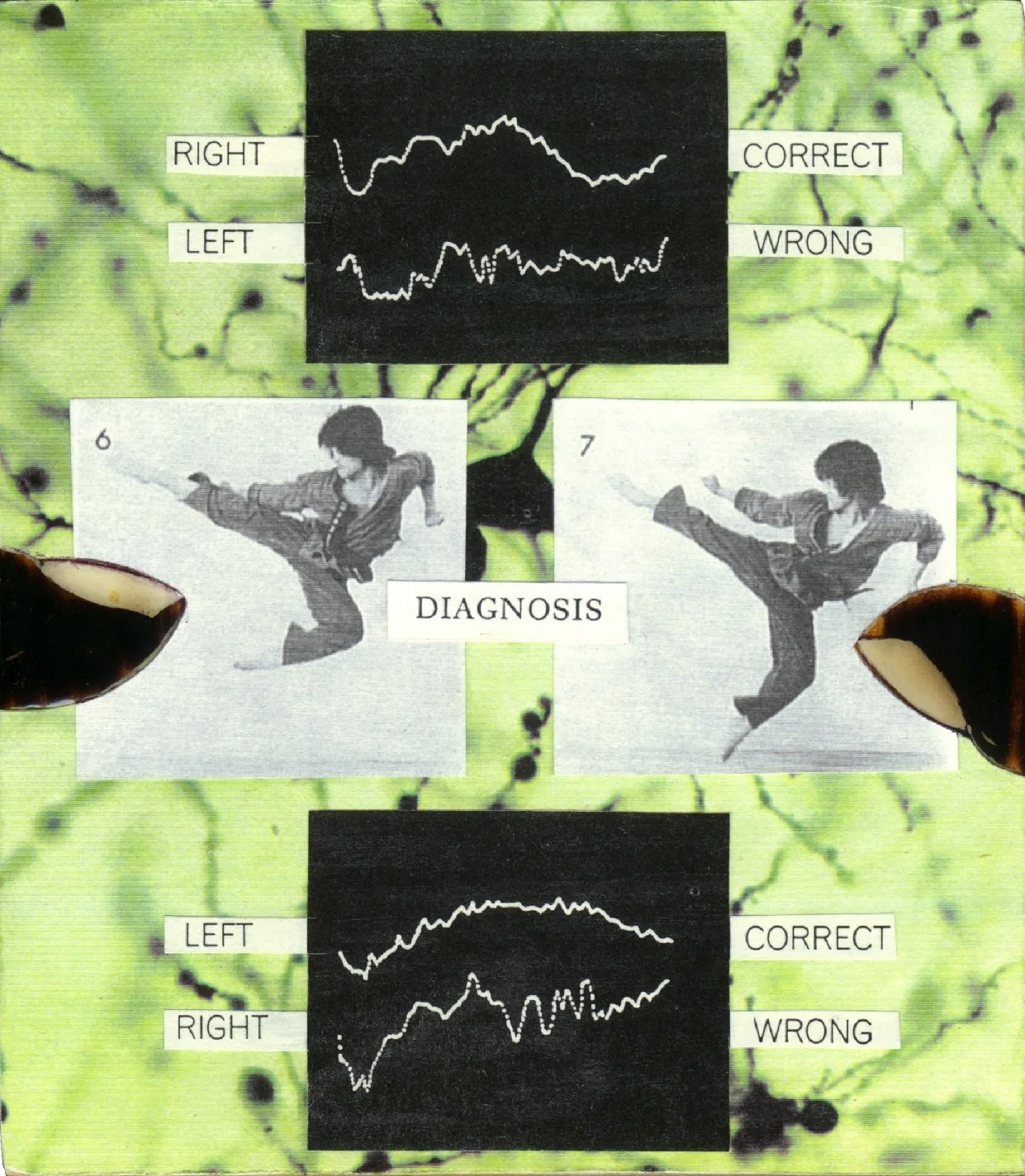 998
