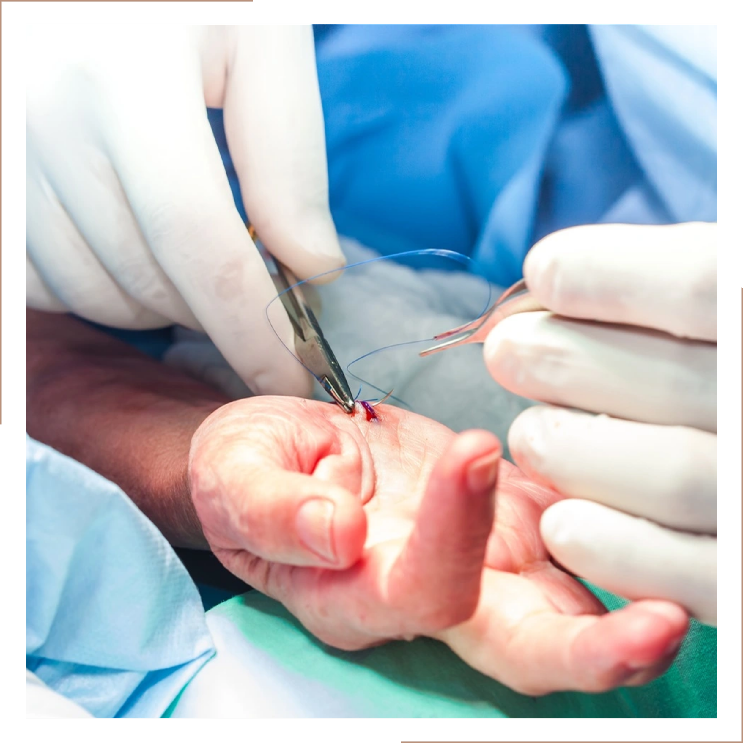 Surgeon performing a surgical procedure on a patient's hand, using surgical instruments and wearing gloves.