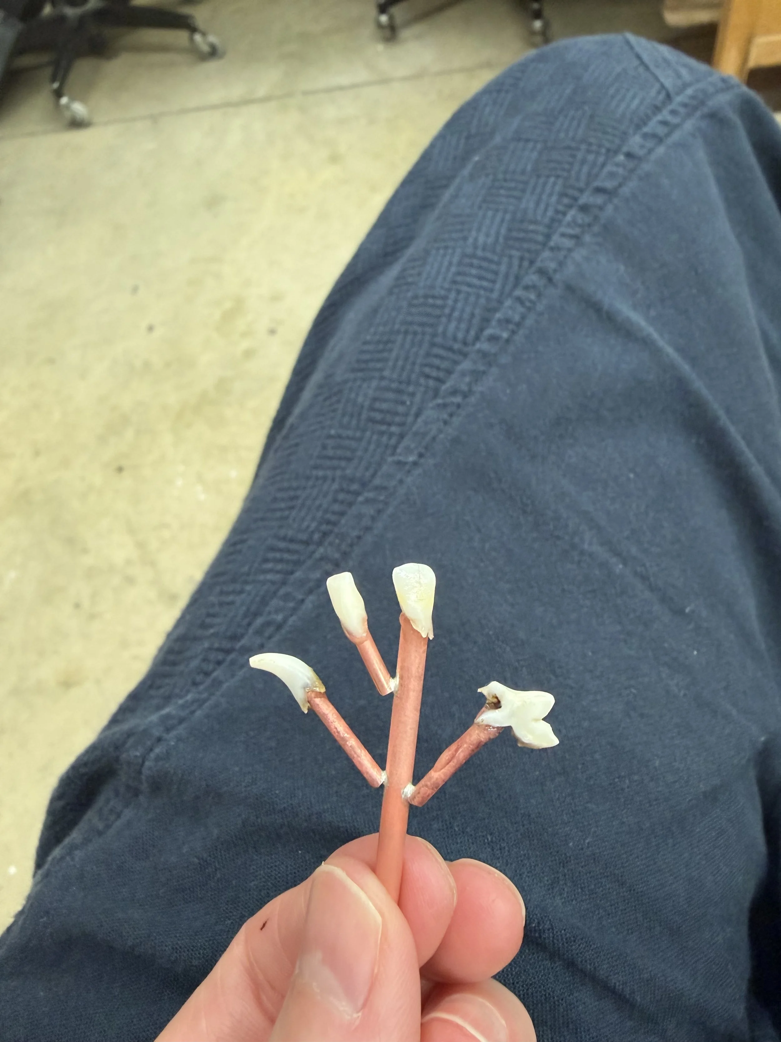 my daughter and puppy's baby teeth