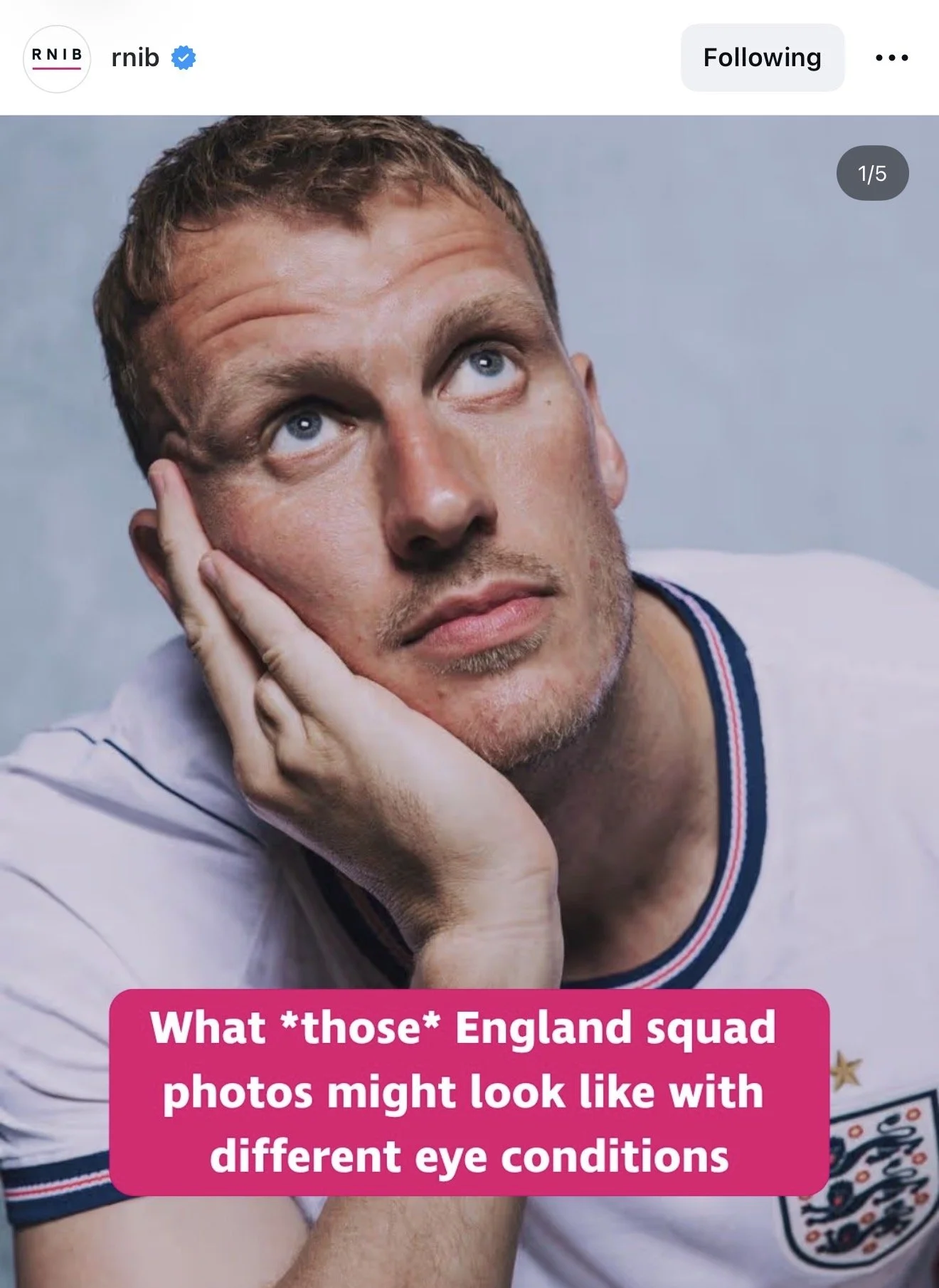 Instagram post from @rnib. England footballer Dan Burn in an England shirt, resting his chin on his hand. Pink text box reads: "What those England squad photos might look like with different eye conditions."