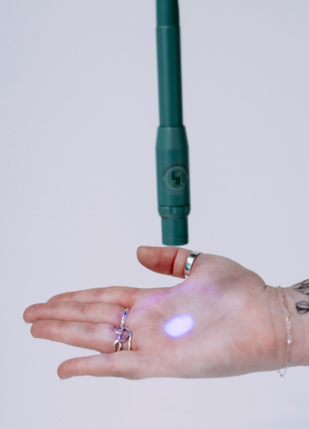 Person holding out their hand with a light blue laser projected onto their palm, and a medical device positioned above the hand.