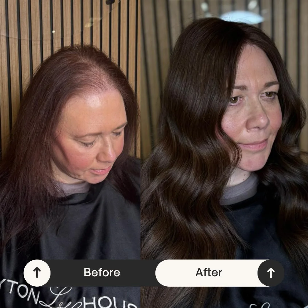 Another beautiful Mesh Integration client ✨

Designed to add density, softness and a seamless blend without compromising the natural hair.

This is why we&rsquo;re so passionate about offering solutions for thinning hair - because everyone deserves t