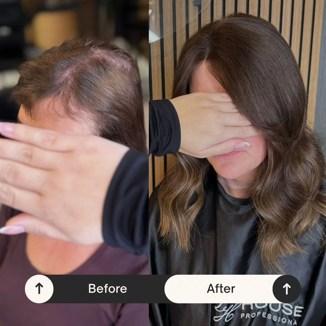 MESH INTEGRATION. Stylist Rosie 🌹 

Our beautiful client came to us struggling with visible scalp and lack of density through the crown. After a bespoke consultation, we created a completely natural transformation using our Mesh Integration System.
