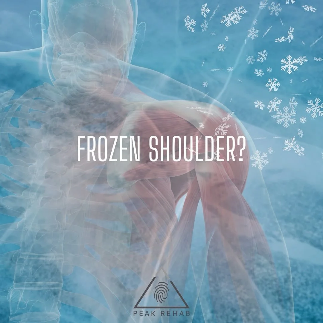 Looks like today is the perfect day to talk about FROZEN 🥶 SHOULDER 🧊🧊🧊🧊

Frozen shoulder, also known as adhesive capsulitis, is a condition characterized by stiffness, pain, and limited range of motion in the shoulder joint. It typically develo