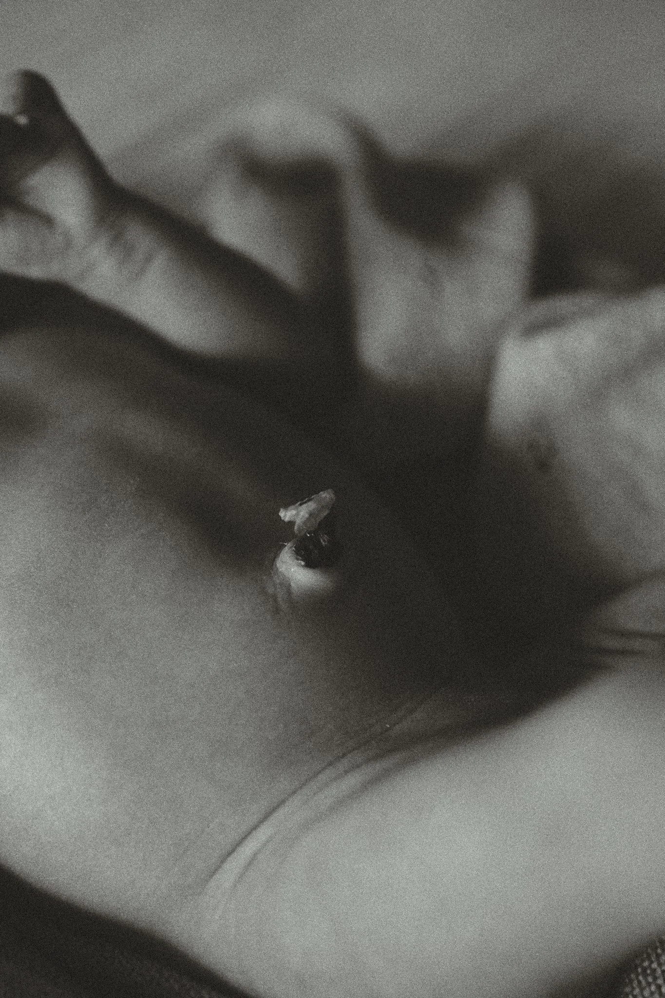 Close-up of a newborn's belly with an umbilical cord stump.