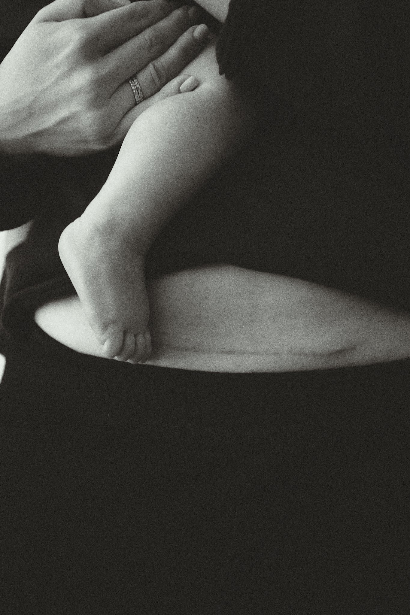 Close-up of a person's hand with a ring, holding a baby with a visible C-section scar on the abdomen.