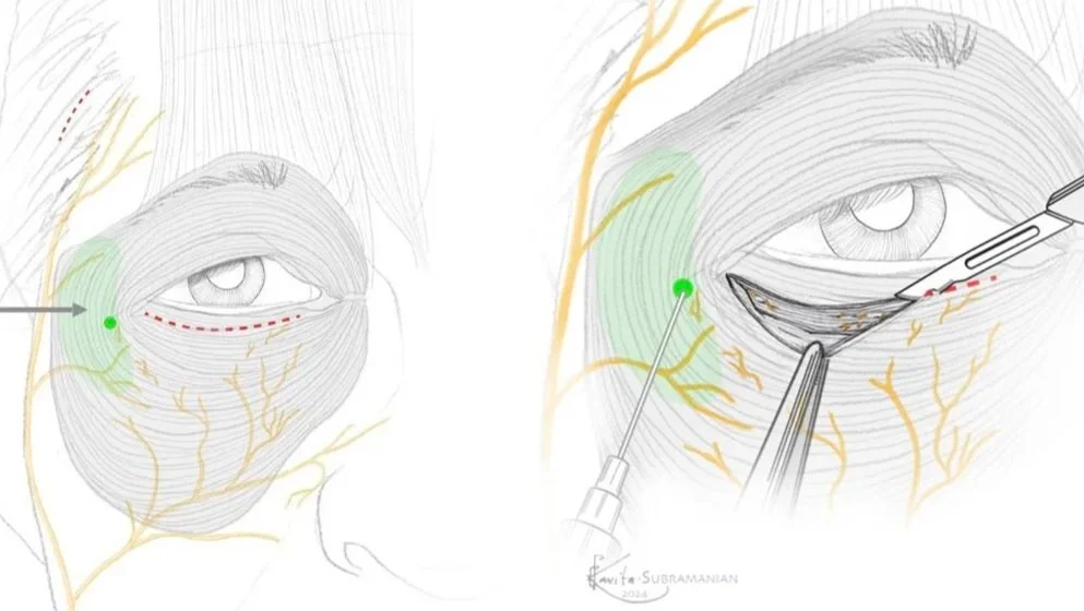 Image Sequence