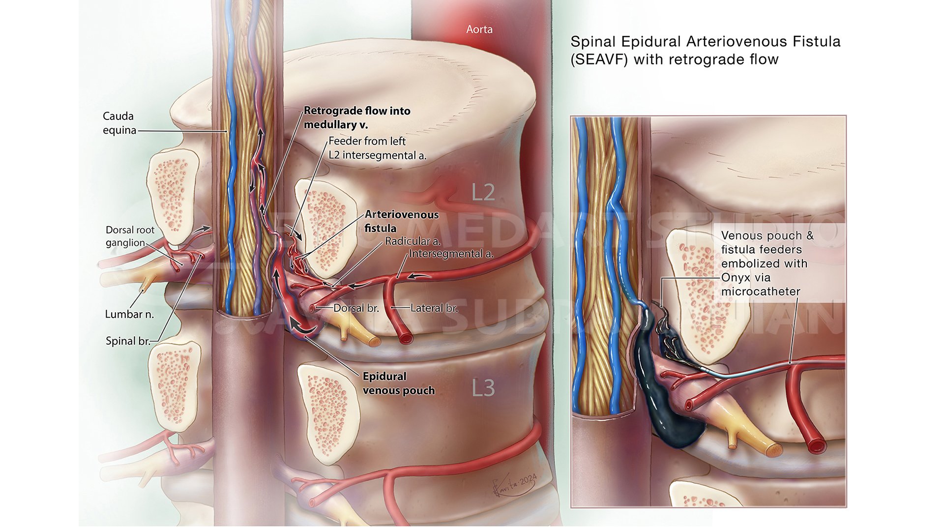 010 Neuroanatomy SEAF_WM 1920 1080.jpg