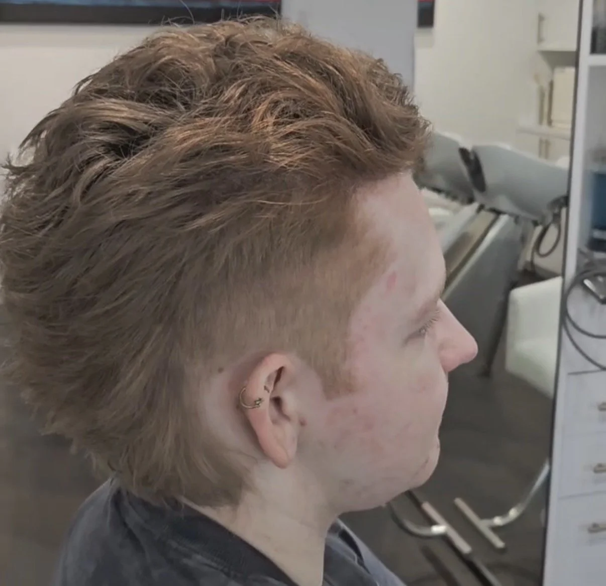 Side profile of a person with a layered, styled haircut, with the sides shaved close to the scalp, in a clinical setting with medical equipment visible in the background.
