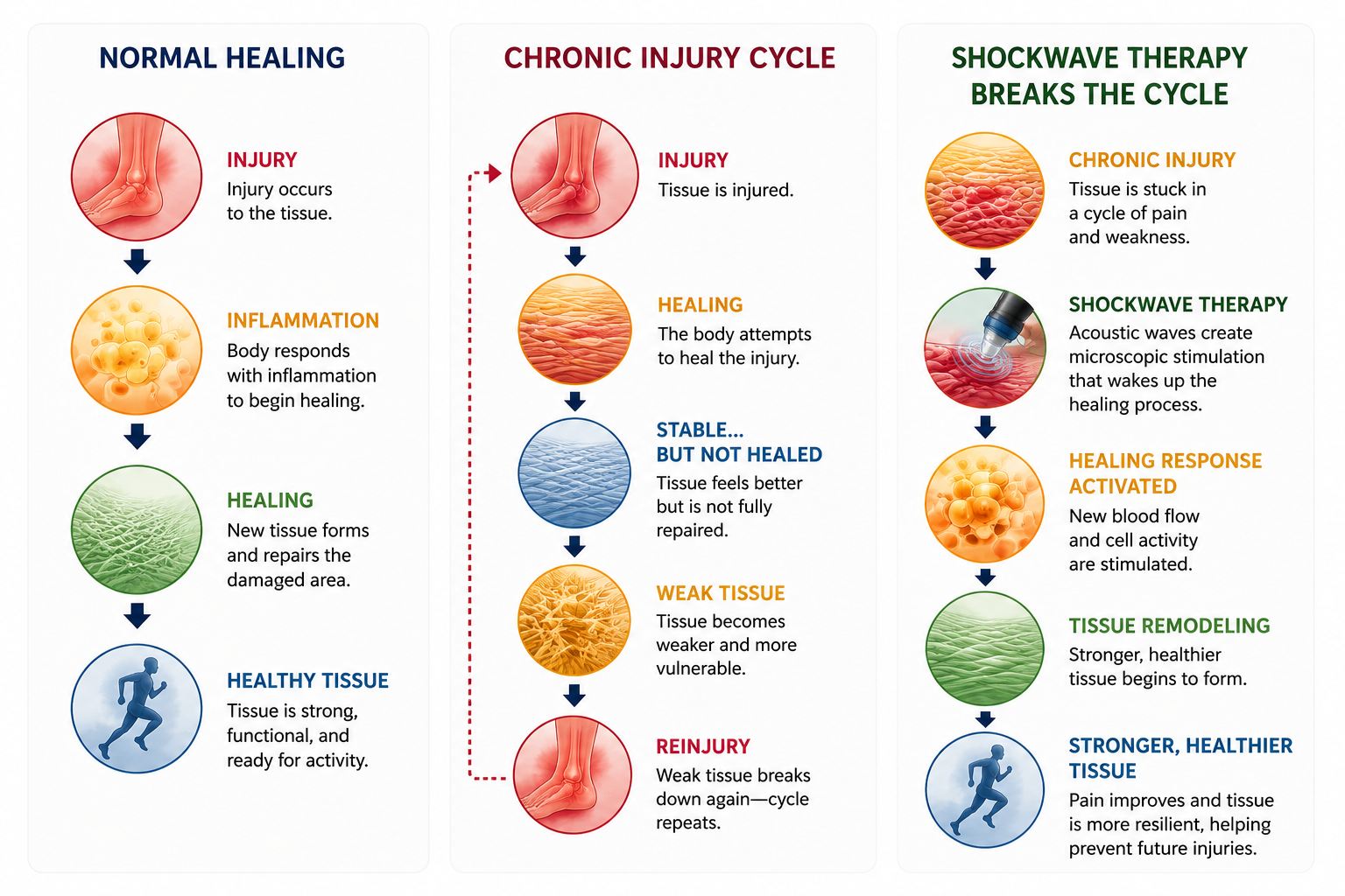 A diagram explaining the process of tissue healing and injury management. It compares normal healing, chronic injury cycle, and shockwave therapy, illustrating stages such as injury, inflammation, healing, stable tissue, weak tissue, and reinjury with corresponding descriptions.