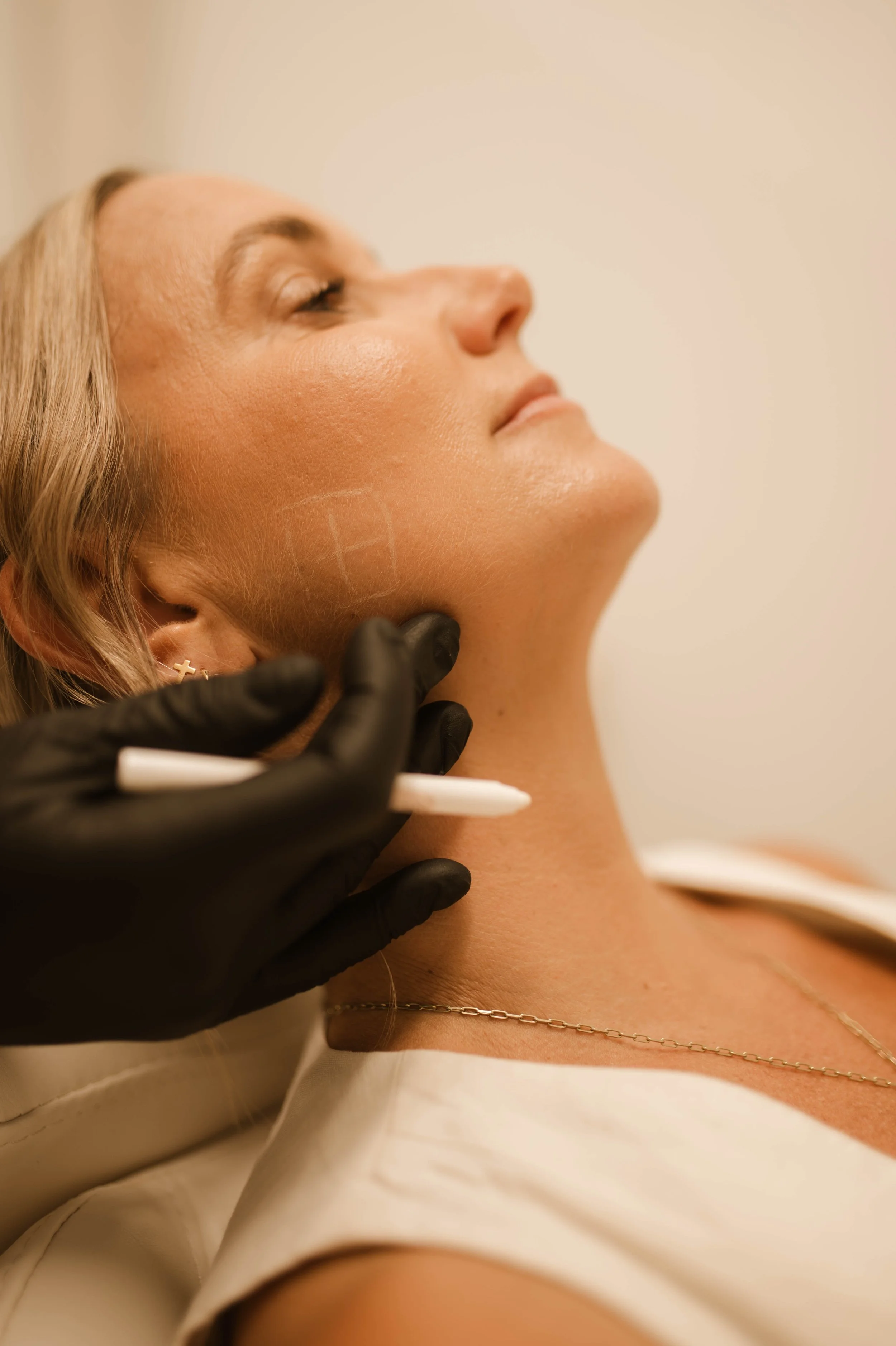 A woman receiving a cosmetic treatment on her neck, with a gloved hand holding a marker or pen near her skin.
