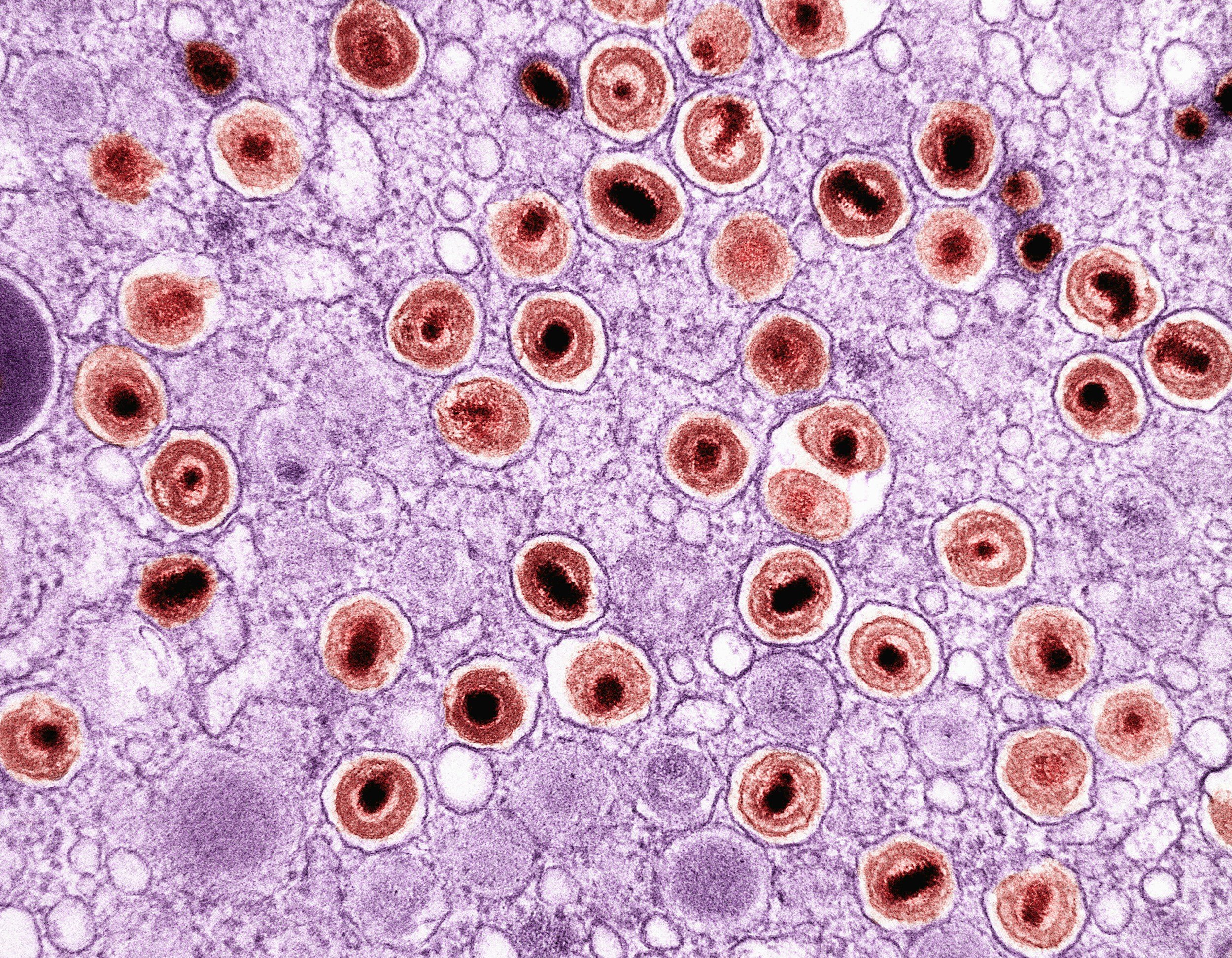 Colored transmission electron microscope image of multiple HIV virus particles, characterized by their spherical shape with a central core and a surrounding lipid envelope.