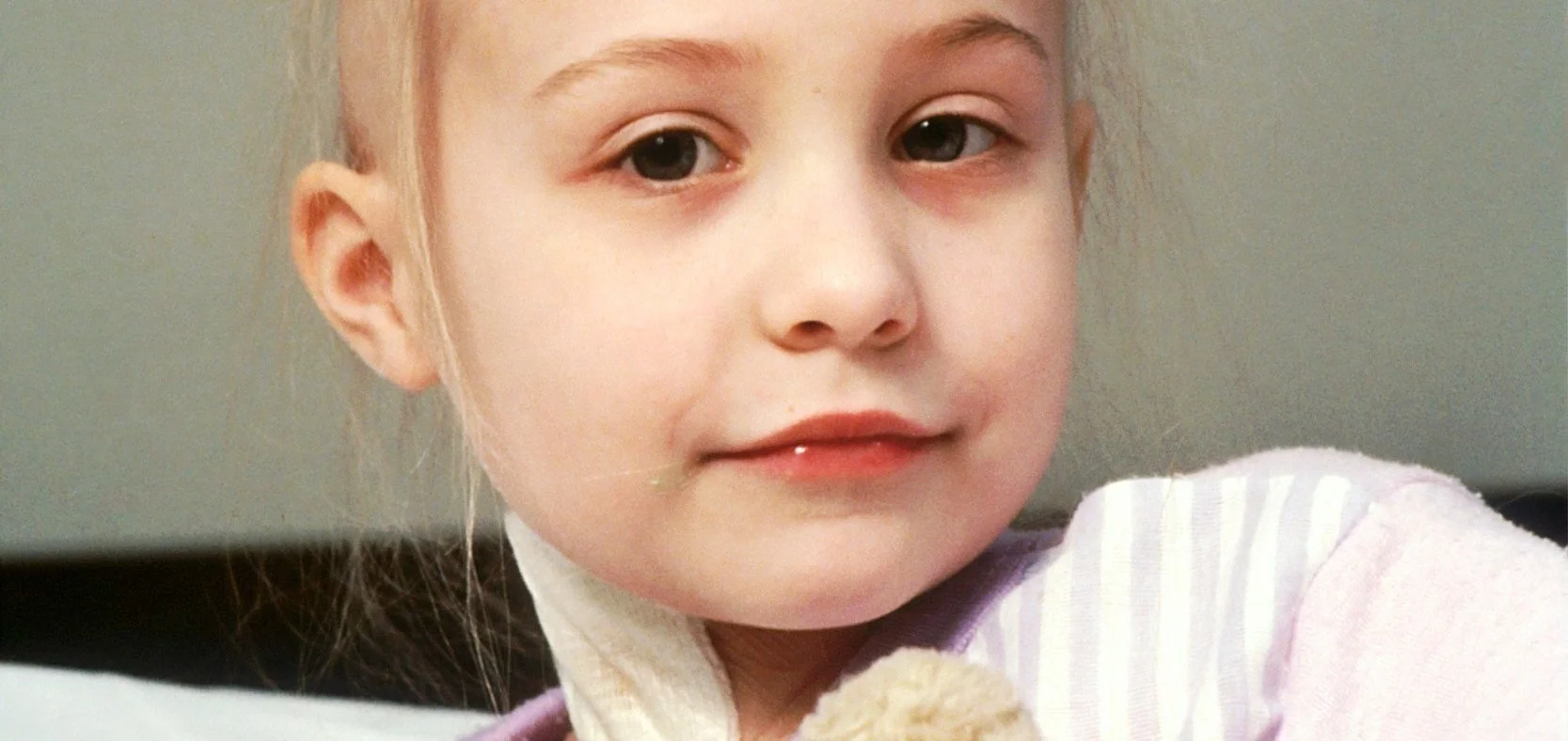 Close-up of a child with light skin and blonde hair in a hospital, wearing a pink and white striped shirt, looking at the camera.