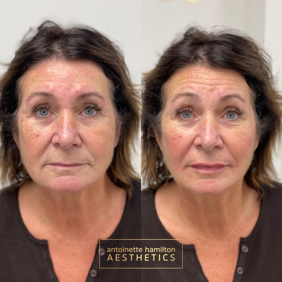 47.png
