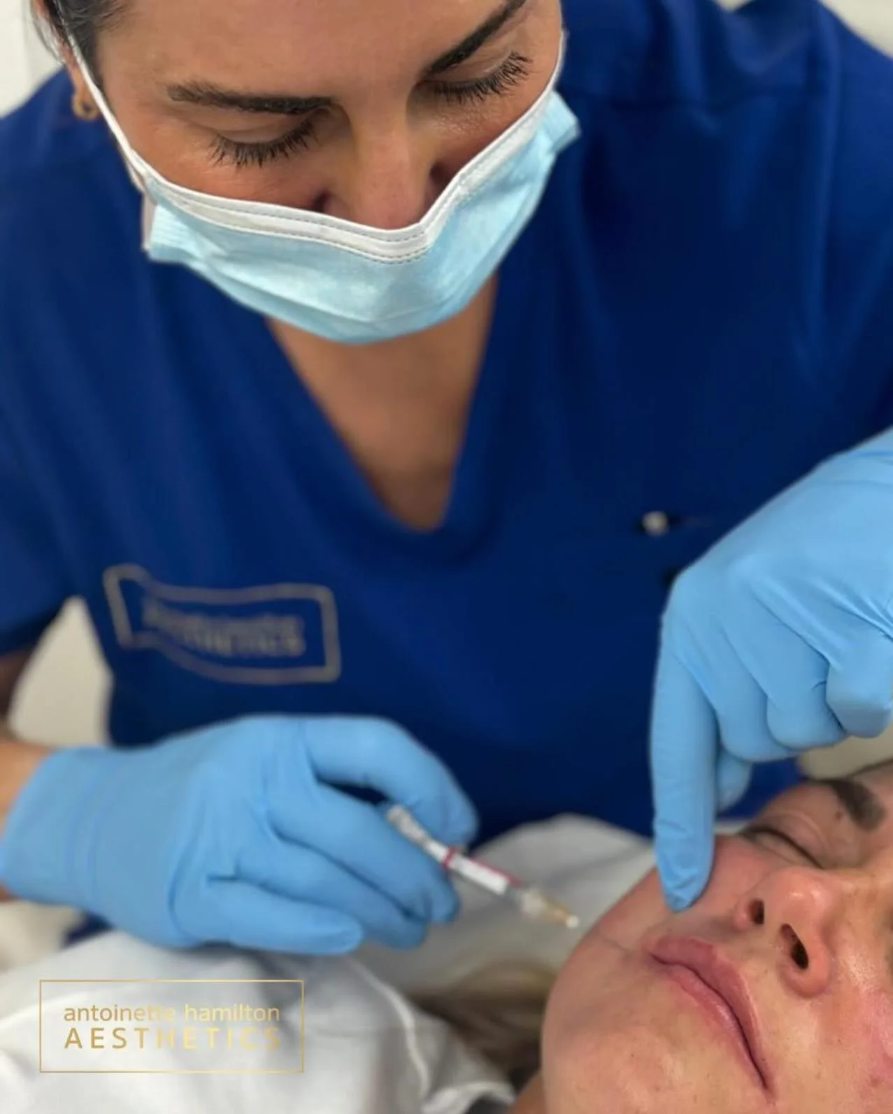 Performing lip filler is never just about adding volume&hellip; it&rsquo;s about respecting facial balance, understanding anatomy, and enhancing the individual in front of you.

This lovely patient received lip filler, placed carefully to hydrate, re