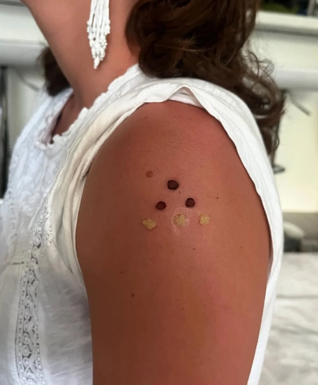 Kambo Community Gathering