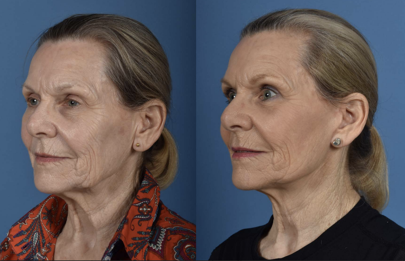 Screenshot 2025-08-01 at 12.47.15 PM.png