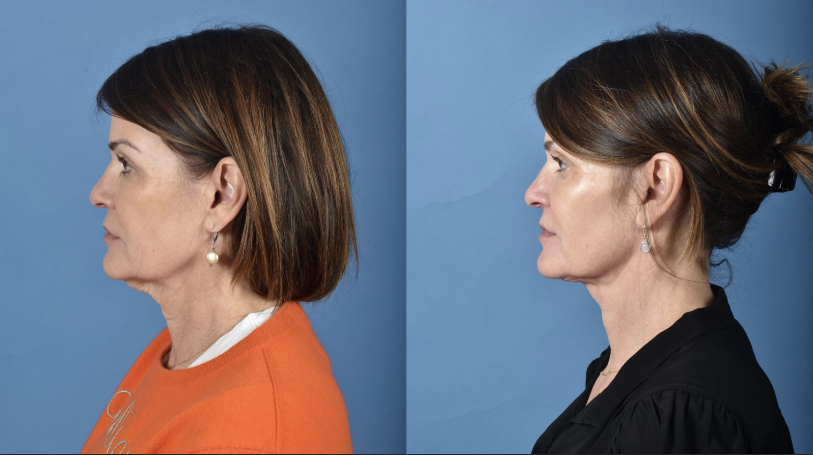 Screenshot 2025-08-01 at 12.46.29 PM.png