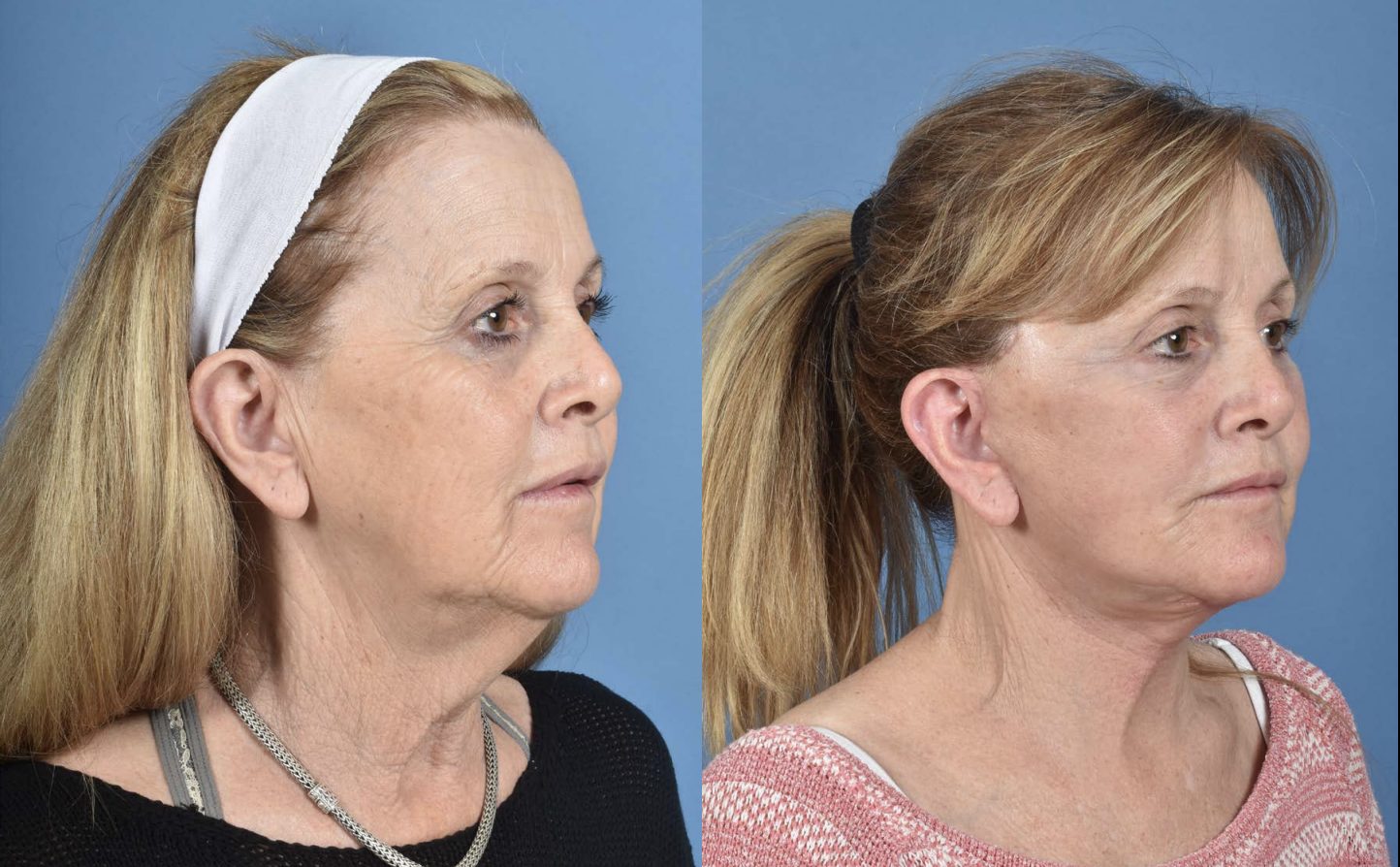 Screenshot 2025-08-01 at 12.46.55 PM.png