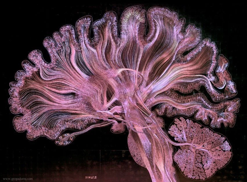 “Okay the brain is plastic?” So what?