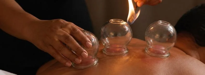 Glass cups being placed on the back during a cupping treatment