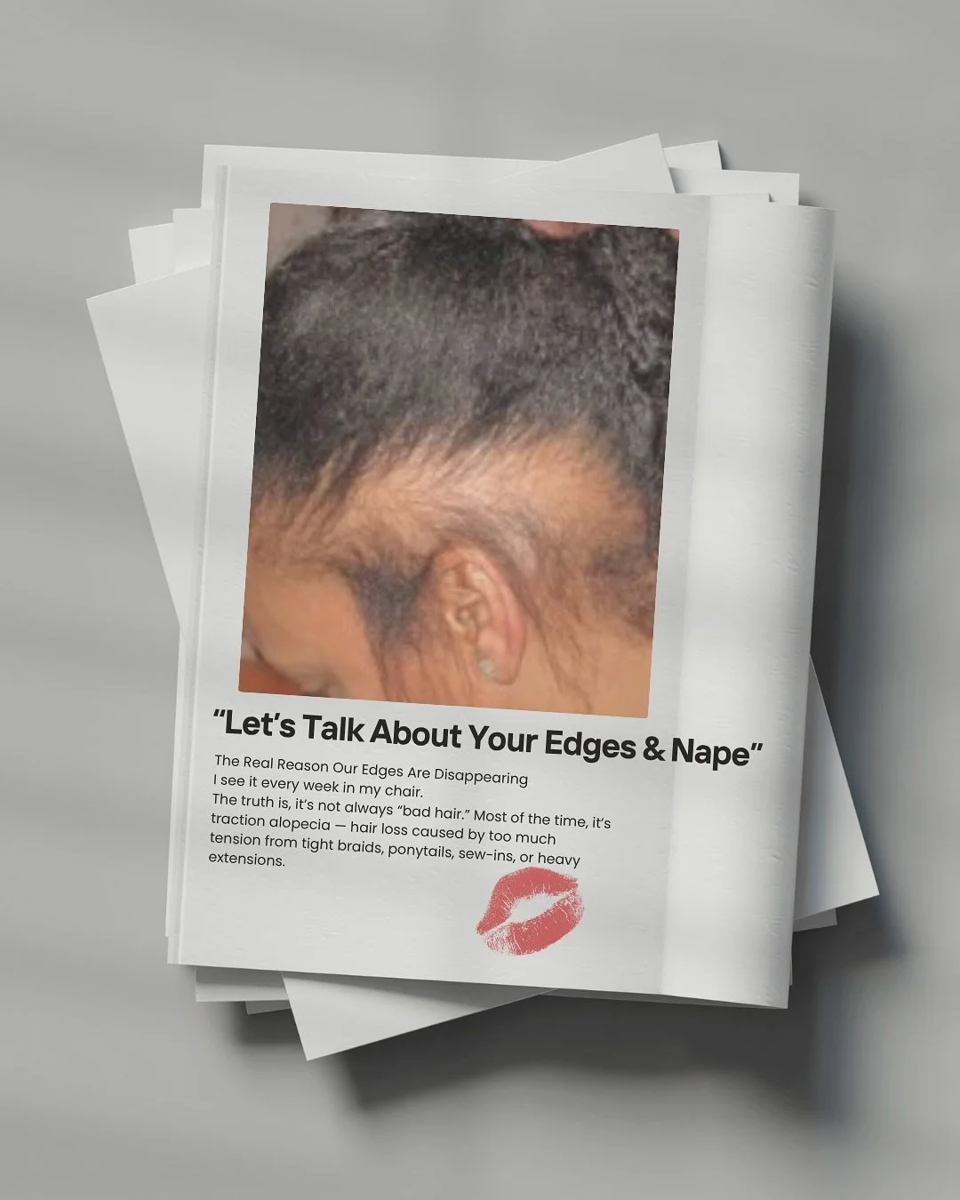 Ladies, if your edges or nape are thinning, you&rsquo;re not alone &mdash; I see it every week in my chair.
The truth is, it&rsquo;s not always &ldquo;bad hair.&rdquo; Most of the time, it&rsquo;s traction alopecia &mdash; hair loss caused by too muc