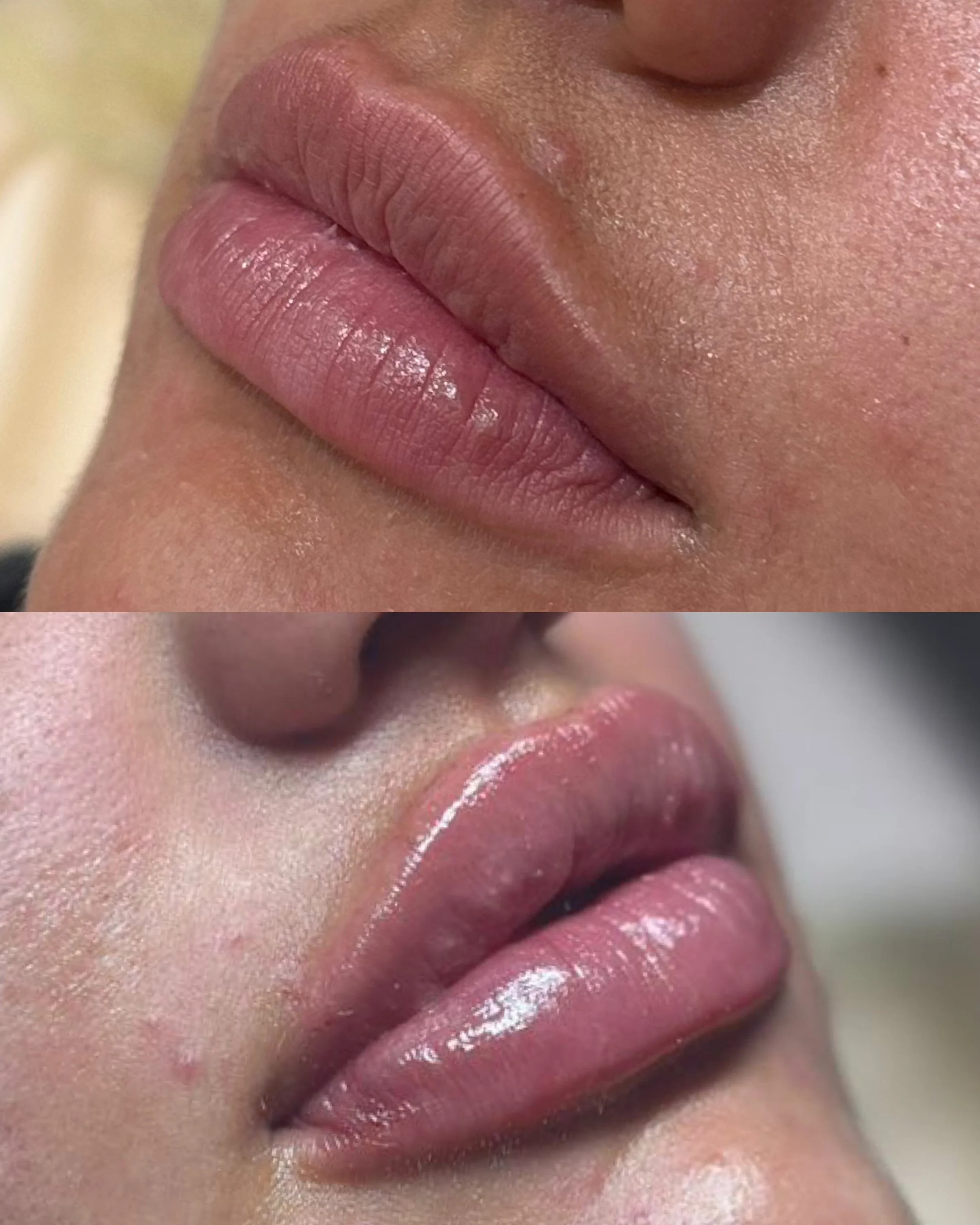 Close-up images of lips, with the top showing natural lips and the bottom showing lips with pink gloss or lipstick applied.