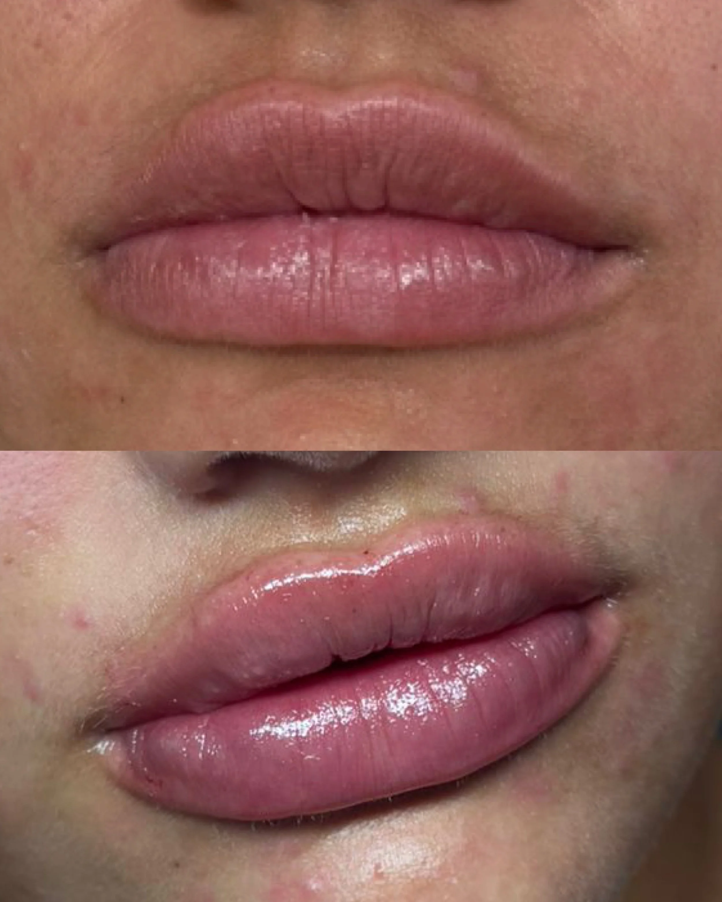 Close-up of lips, showing before and after application of lip gloss or lipstick, with a natural skin tone.