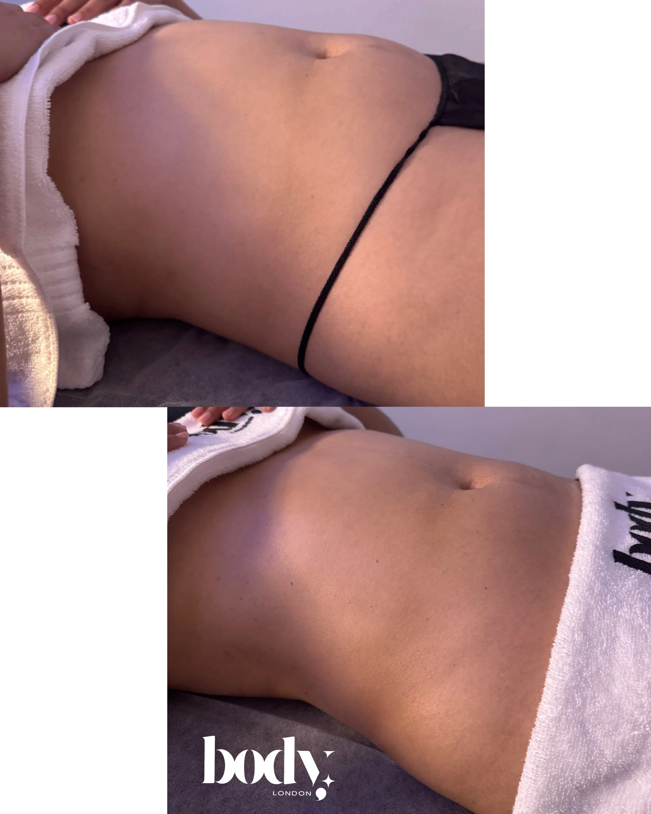 Close-up of a person's midsection lying down, showcasing the stomach and hip area with minimal clothing, in a neutral setting.