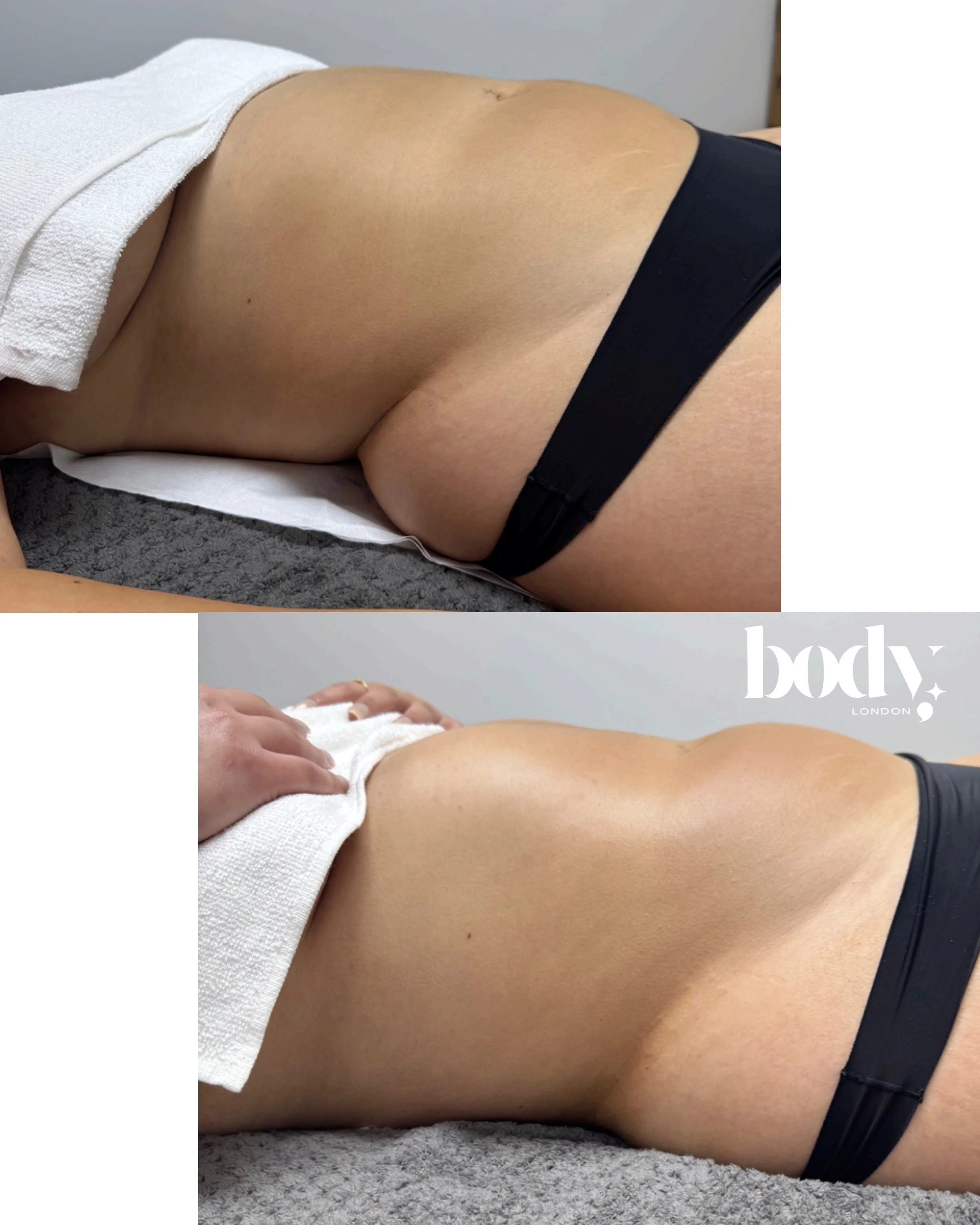 Close-up of a person's lower back and hip area during a massage, with a towel draped over the upper back, and the person lying face down on a massage table with a gray textured blanket. The massage therapist's hand is resting on the person's back in 