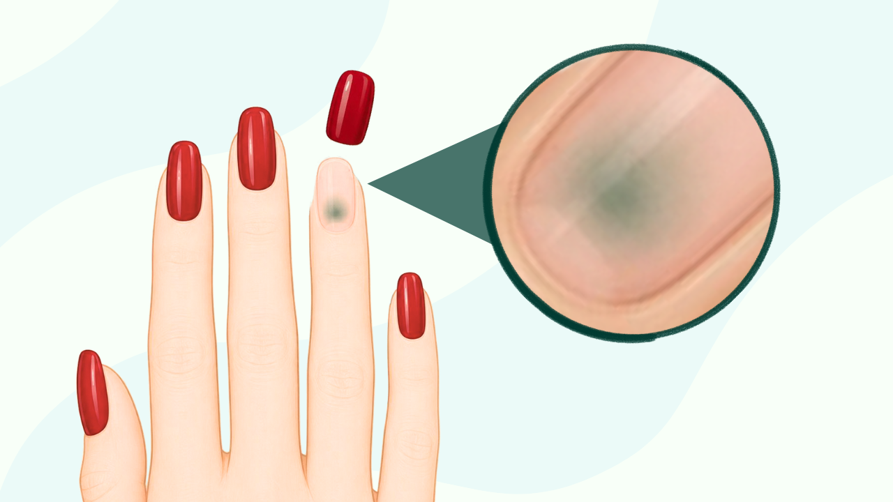Why do greenies happen when wearing press-on nails?