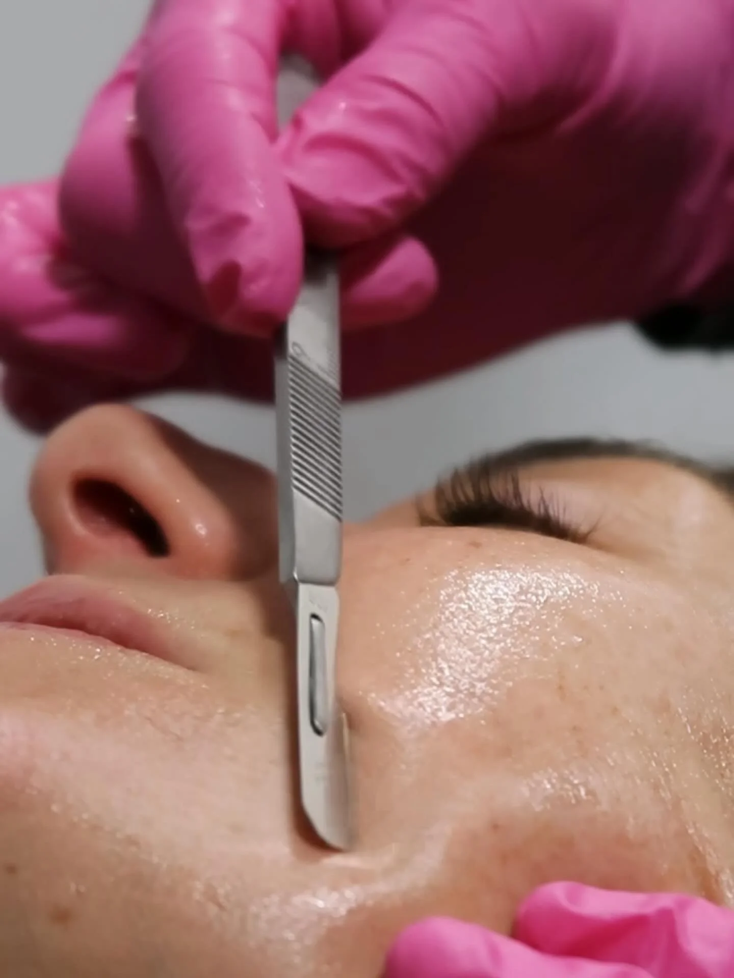 5 Days left of our Black Friday deals 

- 20% Off on all Scarlet RF and Nouvaderm Laser
packages
- $10 per Unit onNeurotoxin treatments
- Complimentary B12 Injection with any purchase
- Lip Fillers at Just $500
- 20% Off Retail Products
- 20% Off All