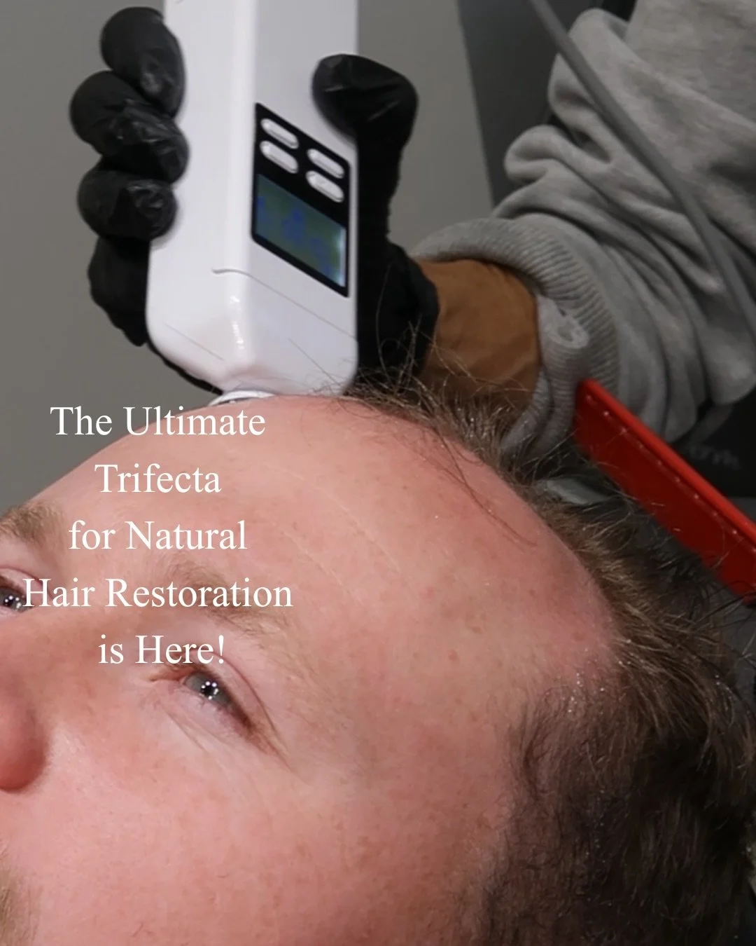 The Ultimate Trifecta for Natural Hair Restoration is here! ✨🧪 We&rsquo;re combining three powerhouse technologies to wake up your follicles and restore your crown:
1️⃣&nbsp;AquaFirme XS: We start by deeply cleansing and detoxing the scalp. This ess