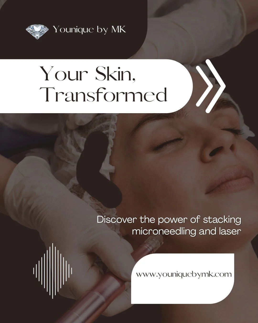 ✨ Did you know? Stacking treatments can boost your results by up to 50% for skin laxity in just 3-6 months! 🌟

Here's my secret to getting 2X the results in half the time! 💪

MAXIMIZE your results with just ONE recovery window! 🕒💖

Who&rsquo;s re