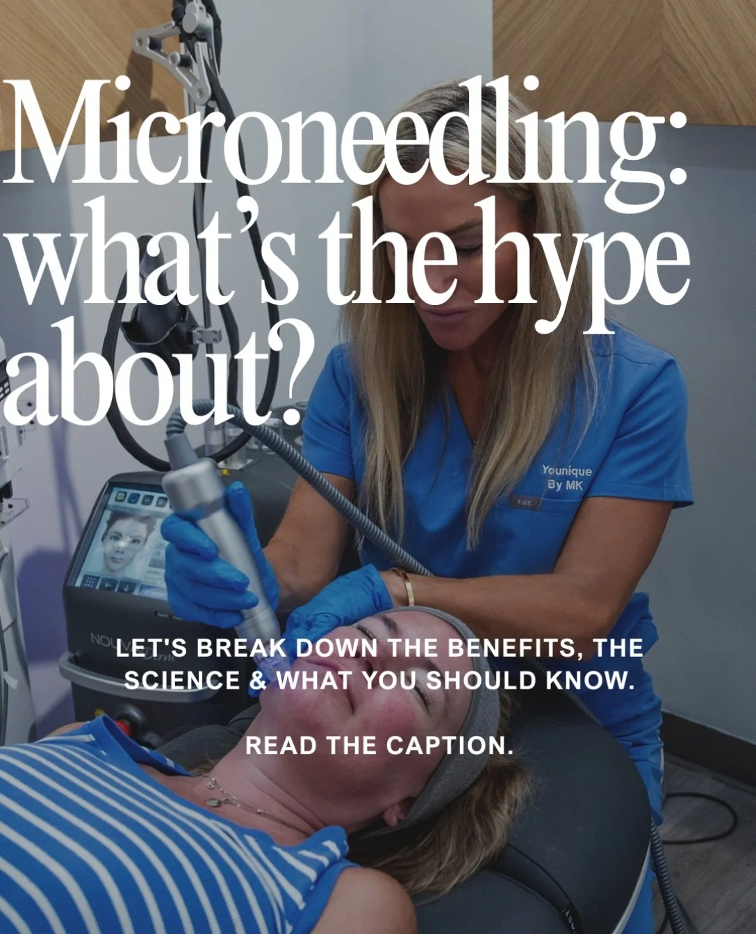 Microneedling: What&rsquo;s the hype about⁉️

✨After the age of 25 we lose on average 1% collagen
every year (or more depending on lifestyle).
✨Each microneedling session increases collagen production by &times;400!
✨Having regular microneedling (4-8